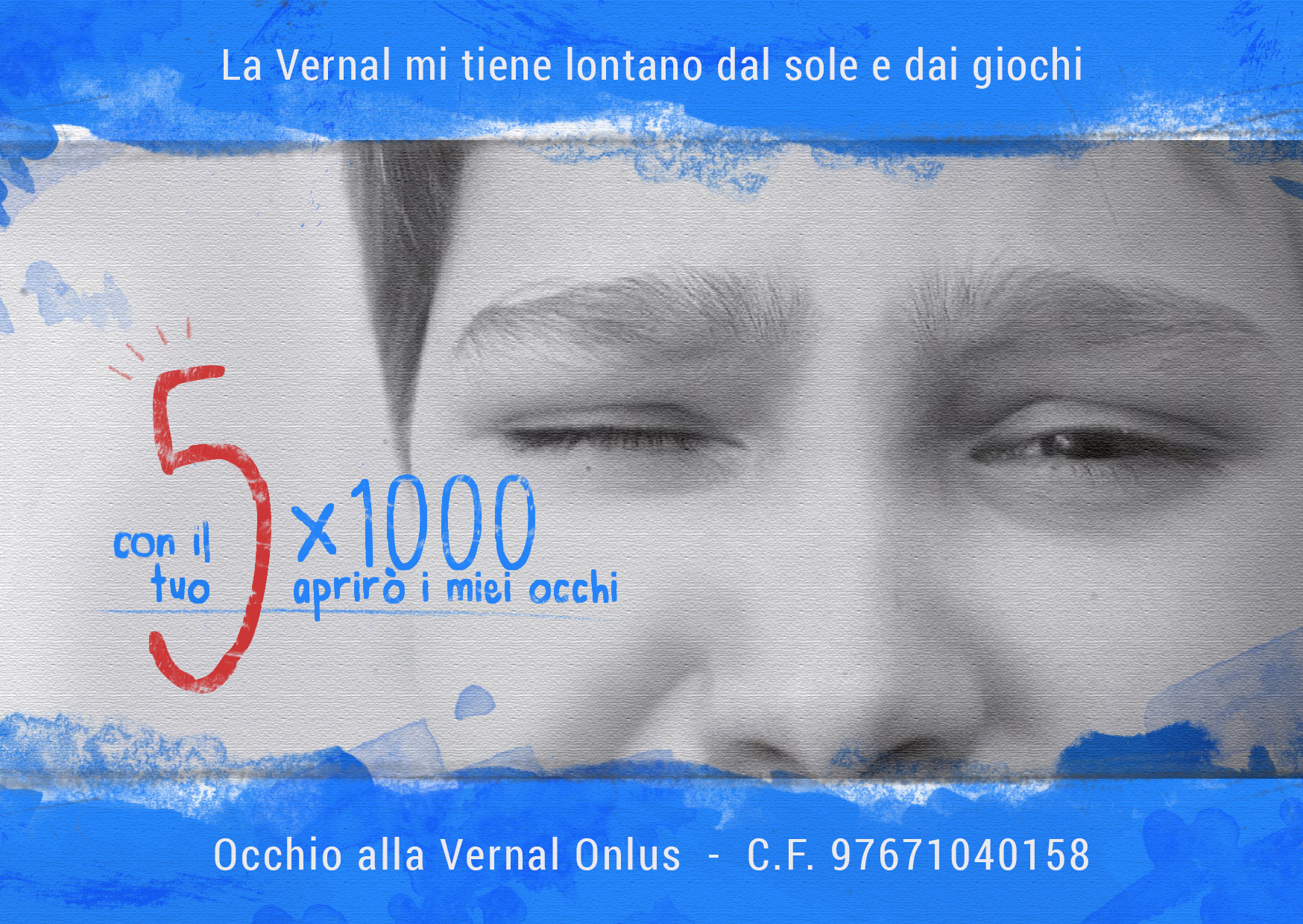 Il tuo 5 x 1000 a Occhio alla Vernal ONLUS